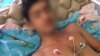 Умерла мать минского подростка, который после жестоких избиений силовиков оказался в коме 